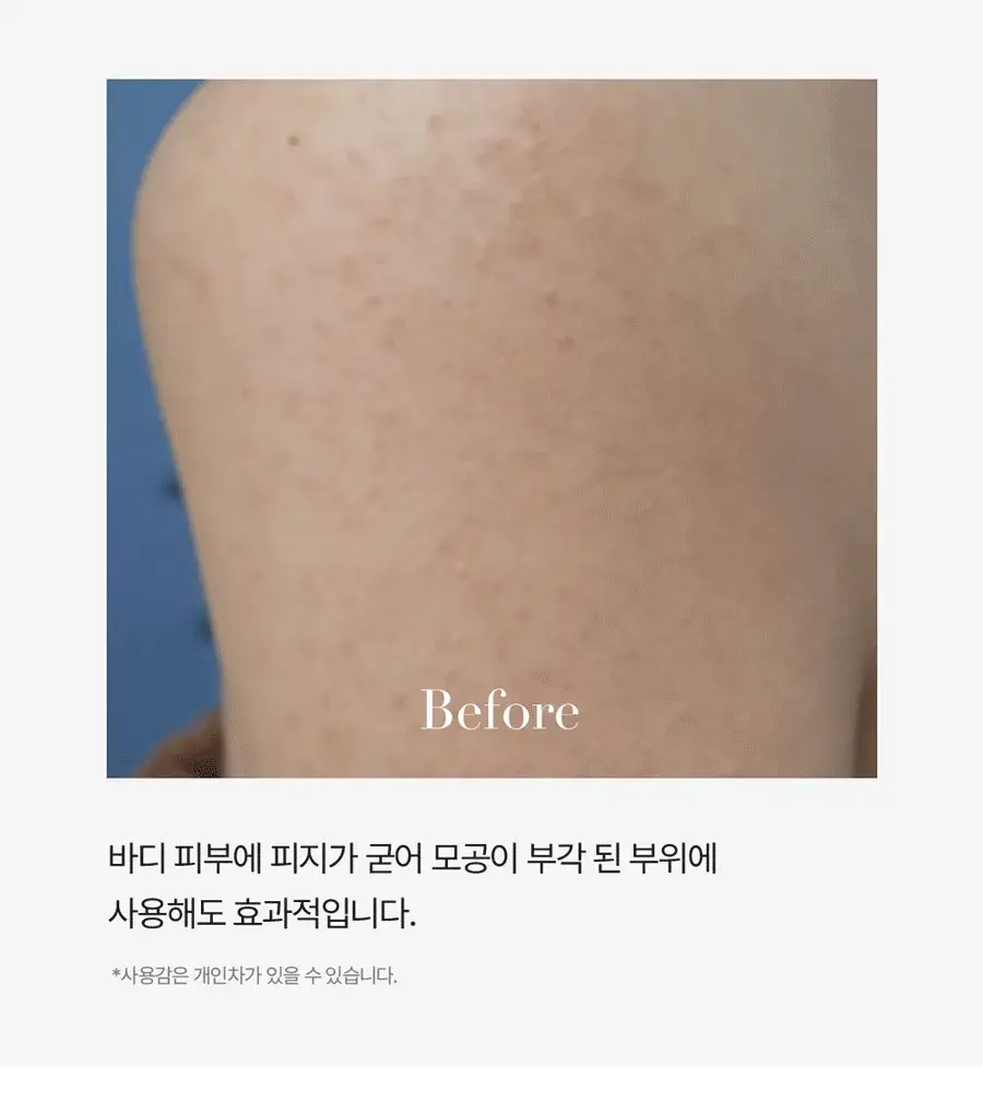 [피지클리너] 메디필 엑스트라 슈퍼9 플러스 2.0 250ml 기획 상세페이지 52